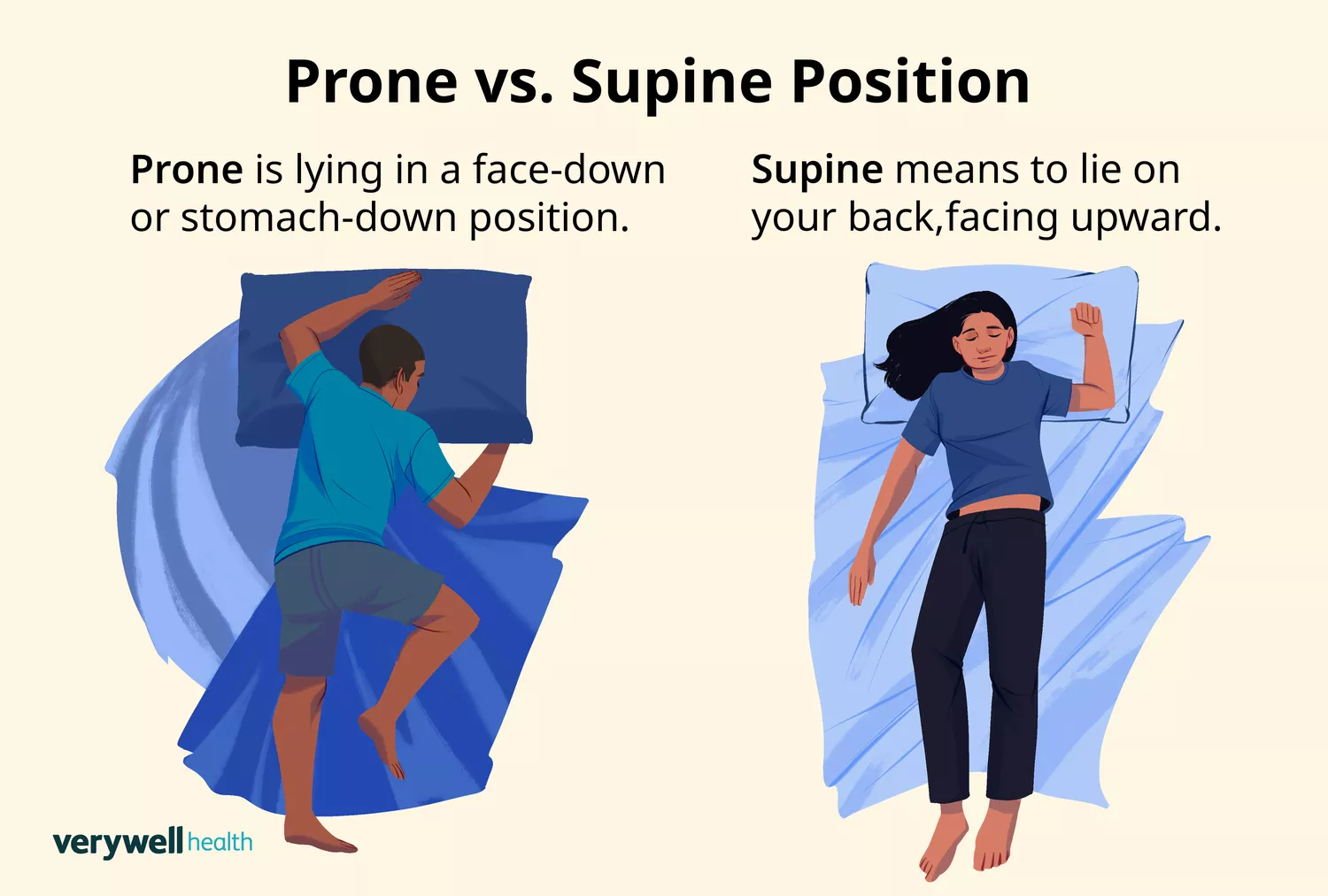 An illustration comparing the prone position face down and the supine position face up.