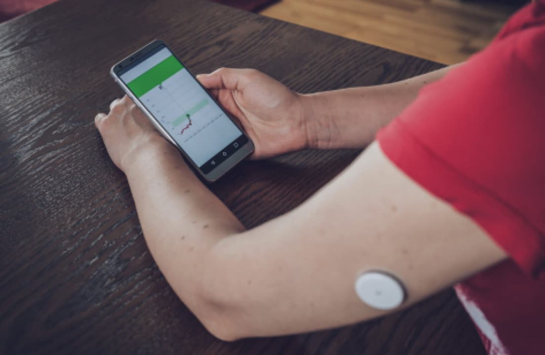 The compact Dexcom G7 wearable glucose sensor, which serves as the hardware foundation for the Stelo OTC model.